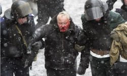Во время киевских беспорядков пострадали 1,5 тысячи человек - МОЗ
